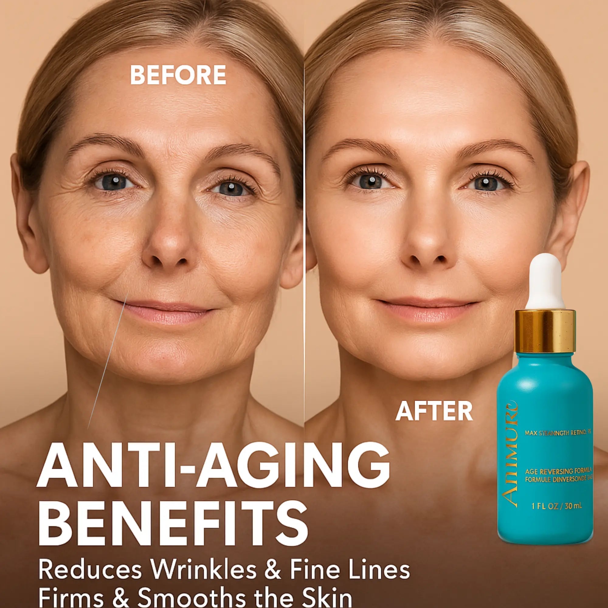 Ammuri Skincare 5% Retinol MAX Potente suero antienvejecimiento para una piel joven